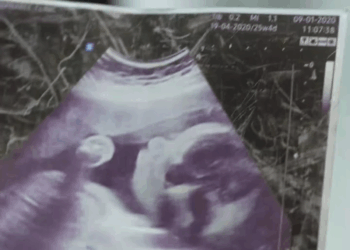 [ตอนต่อไป] 273T1110 A อย่าอวดตัวเองจนเกินพอดี เดี๋ยวจะมีเหตุไม่ดีเกิดขึ้น